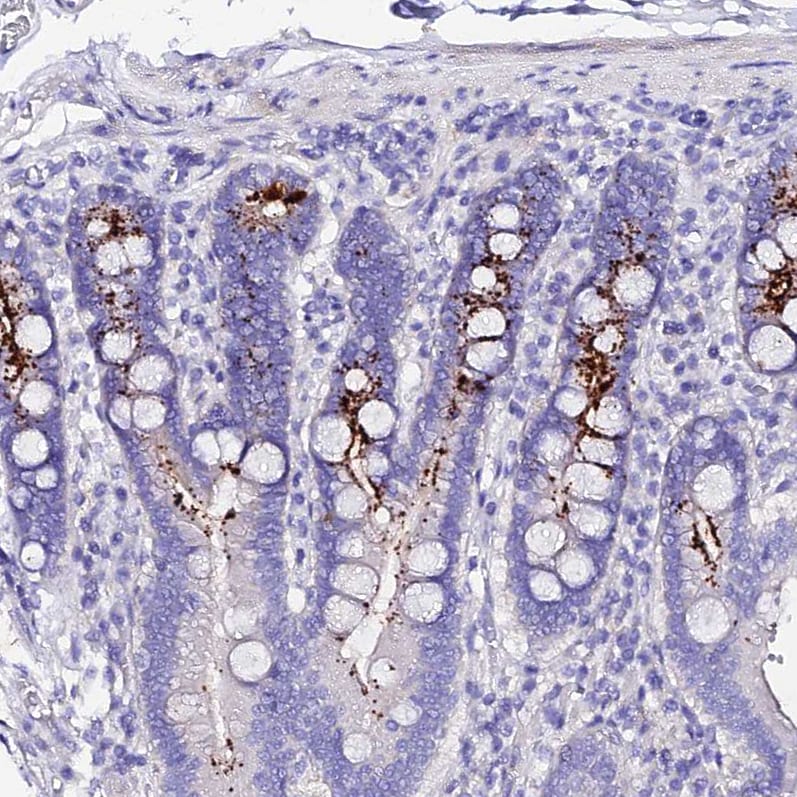 TMEM117 Antibody - BSA Free Immunohistochemistry: TMEM117 Antibody - BSA Free [NBP1-94078]