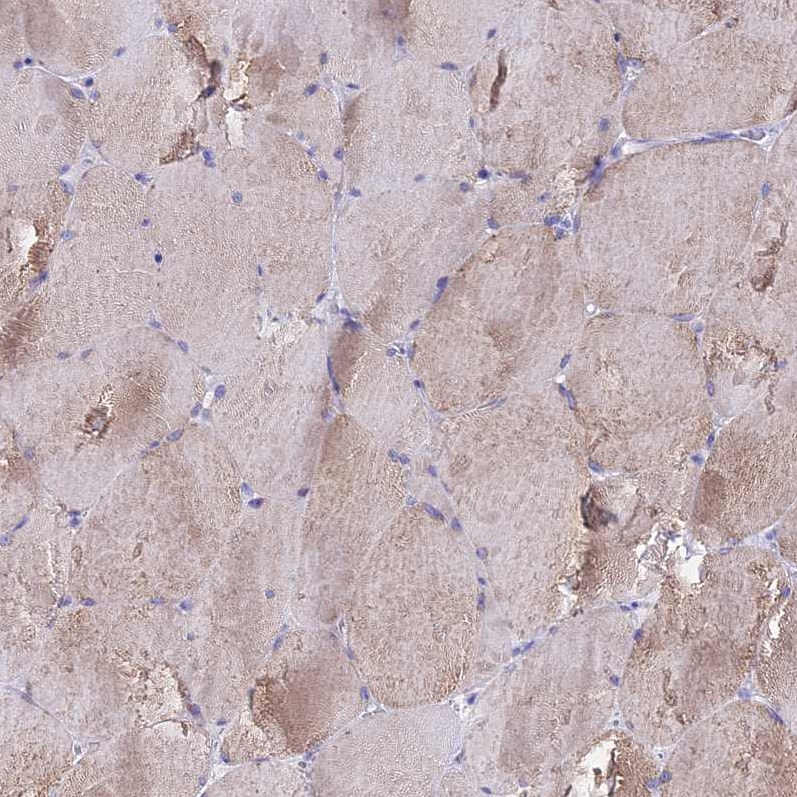 TMEM117 Antibody - BSA Free Immunohistochemistry: TMEM117 Antibody - BSA Free [NBP1-94078]