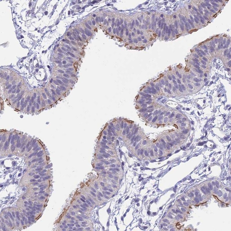 CFAP298 Antibody - BSA Free Immunohistochemistry: CFAP298 Antibody - BSA Free [NBP1-94082]