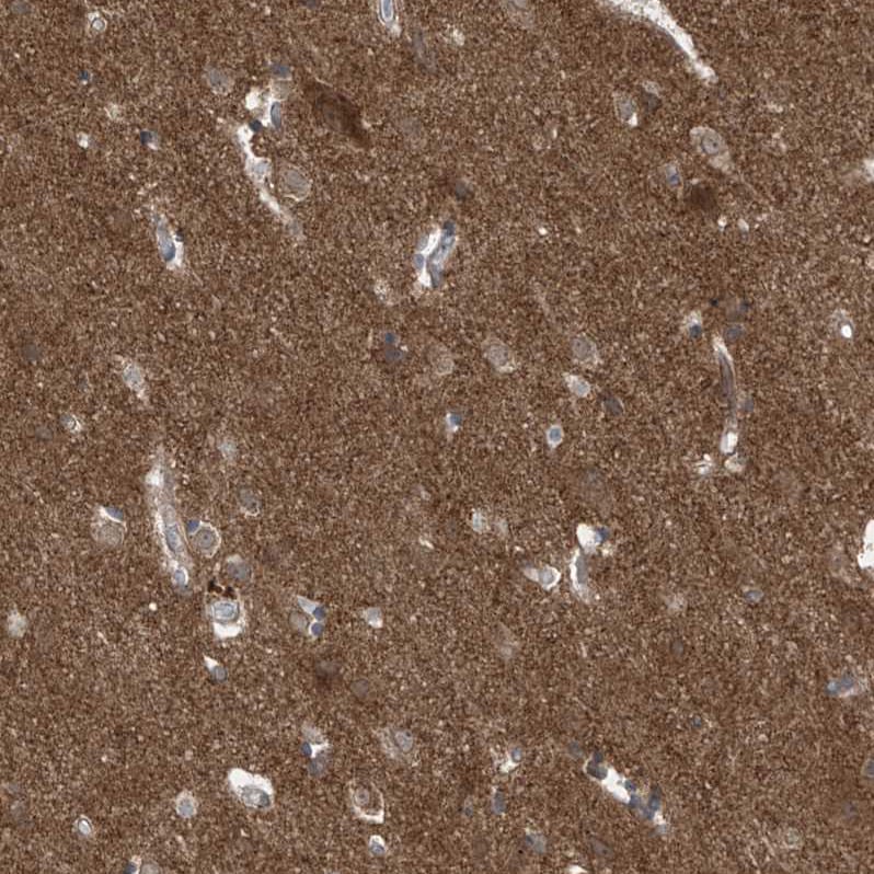 LAGE3 Antibody - BSA Free Immunohistochemistry: LAGE3 Antibody - BSA Free [NBP1-94092]