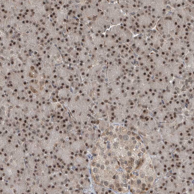 LAGE3 Antibody - BSA Free Immunohistochemistry: LAGE3 Antibody - BSA Free [NBP1-94092]
