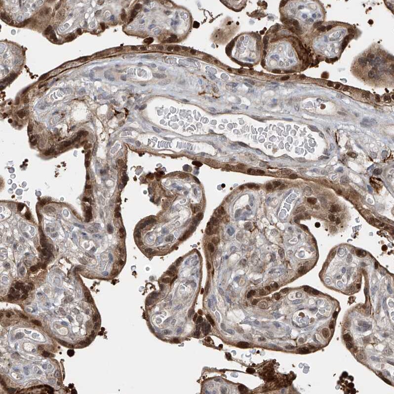 LAGE3 Antibody - BSA Free Immunohistochemistry: LAGE3 Antibody - BSA Free [NBP1-94092]