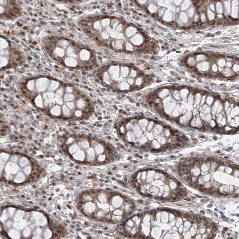 LAGE3 Antibody - BSA Free Immunohistochemistry: LAGE3 Antibody - BSA Free [NBP1-94092]