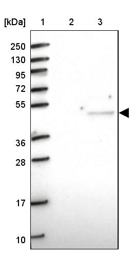 CRTAP Antibody - BSA Free Western Blot: CRTAP Antibody - BSA Free [NBP1-94105]