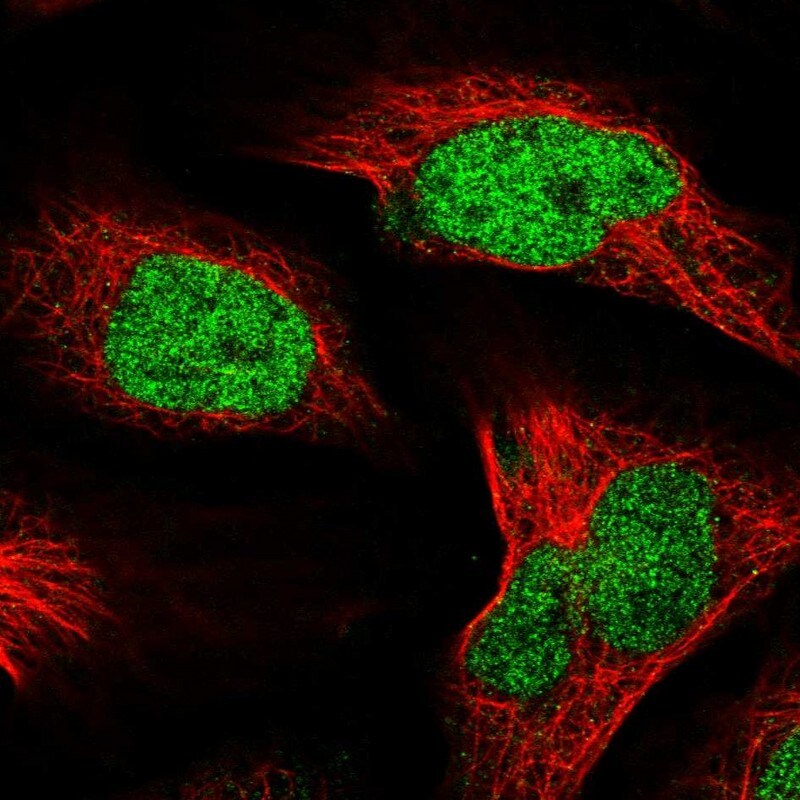 Nucleolar Protein 4 Like Antibody - BSA Free Immunocytochemistry/ Immunofluorescence: Nucleolar Protein 4 Like Antibody - BSA Free [NBP1-94115]