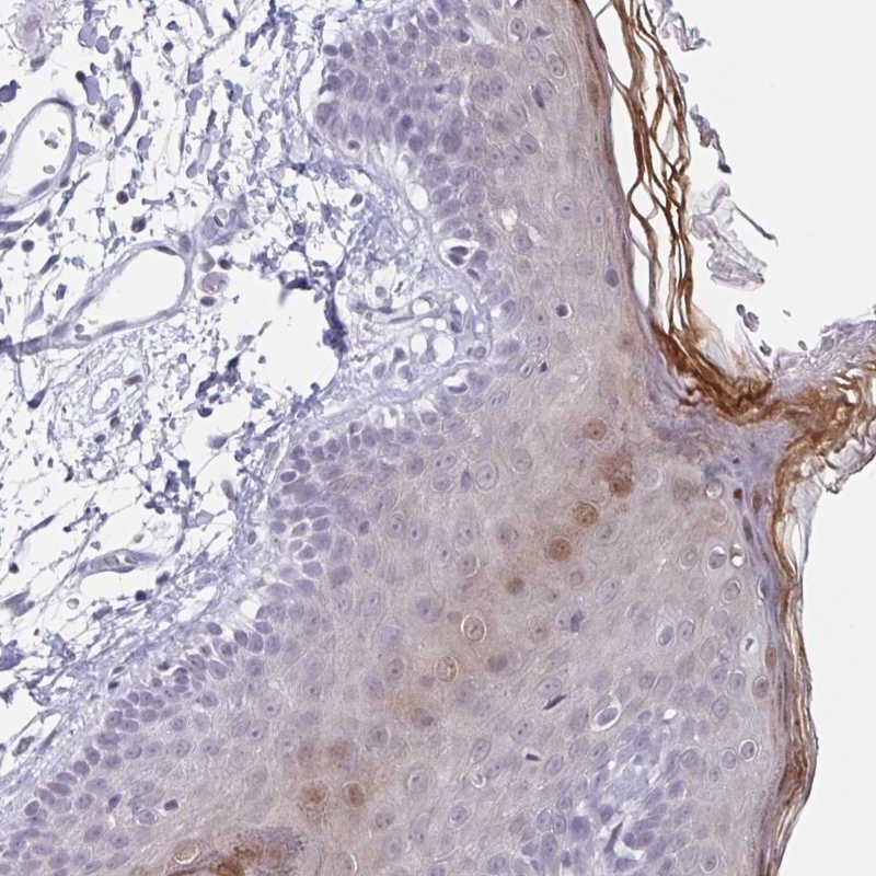 LCE6A Antibody - BSA Free Immunohistochemistry: LCE6A Antibody - BSA Free [NBP1-94116]