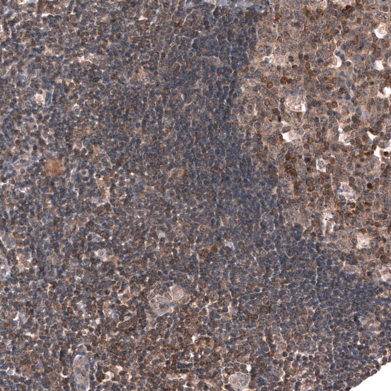 SPATA48 Antibody - BSA Free Immunohistochemistry: SPATA48 Antibody - BSA Free [NBP1-94145]