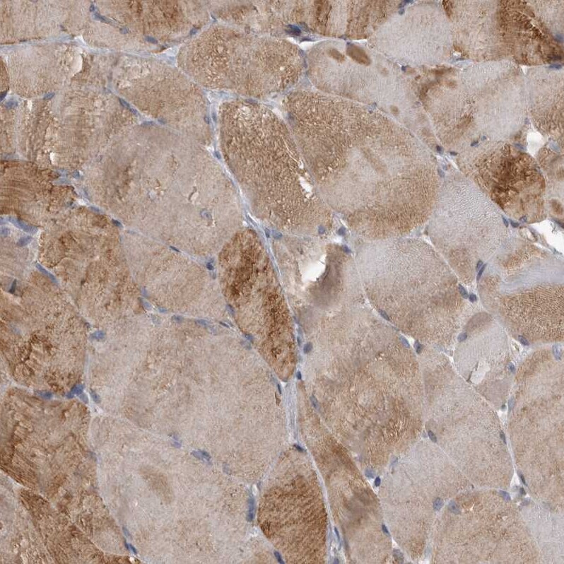 SPATA48 Antibody - BSA Free Immunohistochemistry: SPATA48 Antibody - BSA Free [NBP1-94145]