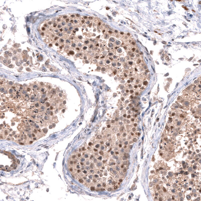SPATA48 Antibody - BSA Free Immunohistochemistry: SPATA48 Antibody - BSA Free [NBP1-94145]