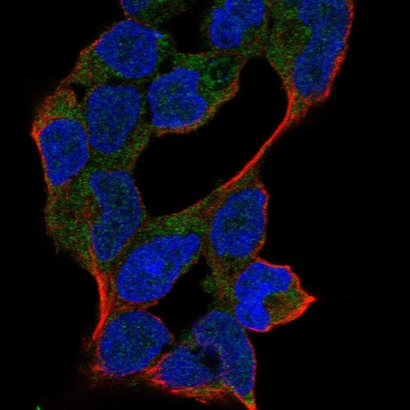 ANKRD46 Antibody - BSA Free Immunocytochemistry/ Immunofluorescence: ANKRD46 Antibody - BSA Free [NBP1-94147]