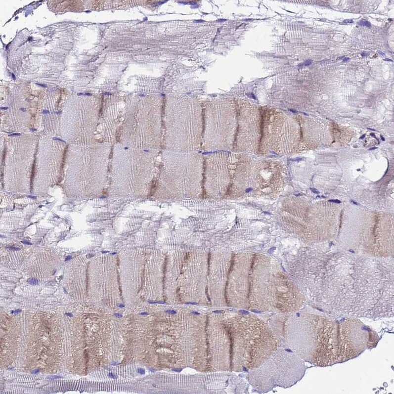 UGT2A1 Antibody - BSA Free Immunohistochemistry: UGT2A1 Antibody - BSA Free [NBP1-94148]