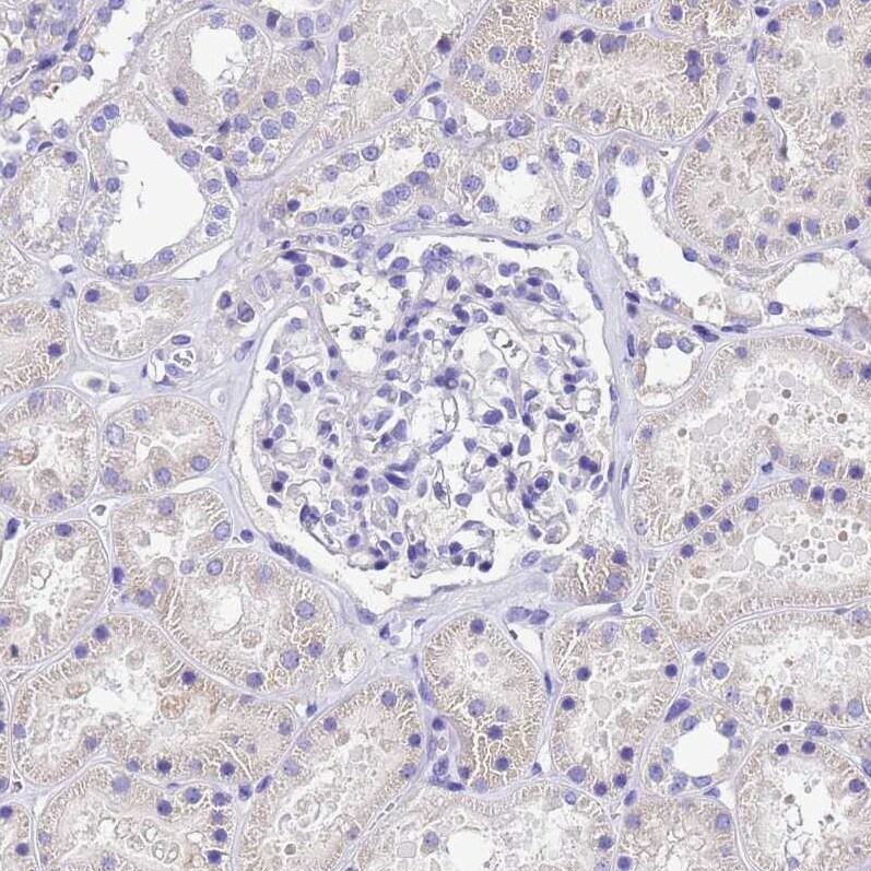 UGT2A1 Antibody - BSA Free Immunohistochemistry: UGT2A1 Antibody - BSA Free [NBP1-94148]