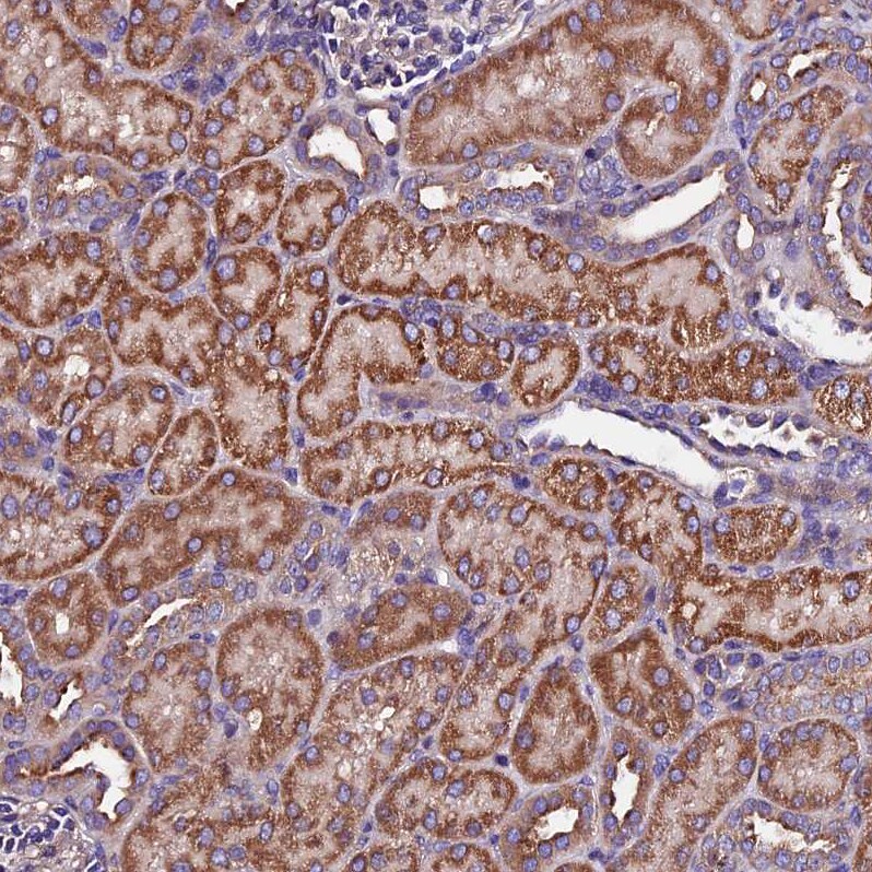 CLN5 Antibody - BSA Free Immunohistochemistry: CLN5 Antibody - BSA Free [NBP1-94150]