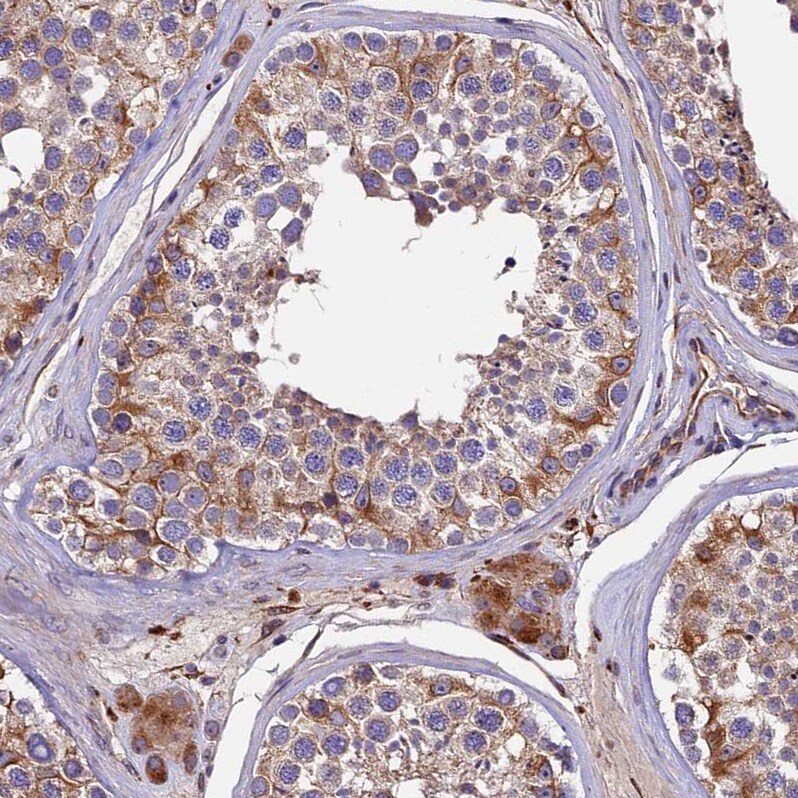 CLN5 Antibody - BSA Free Immunohistochemistry: CLN5 Antibody - BSA Free [NBP1-94150]