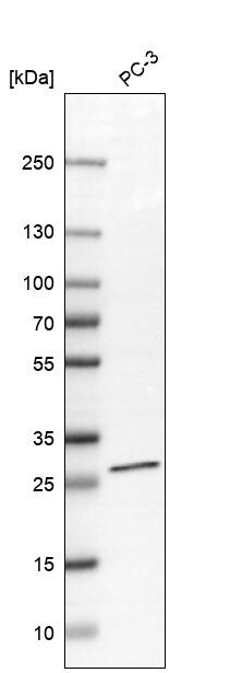 TIMM29 Antibody - BSA Free Western Blot: TIMM29 Antibody - BSA Free [NBP1-94151]