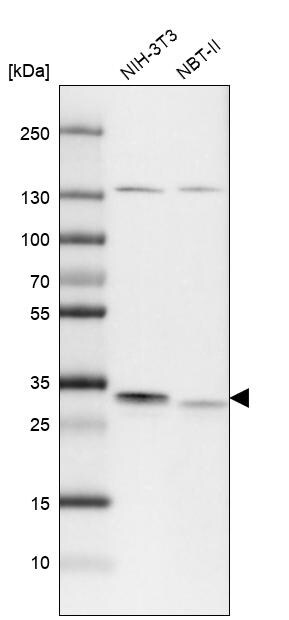 TIMM29 Antibody - BSA Free Western Blot: TIMM29 Antibody - BSA Free [NBP1-94151]