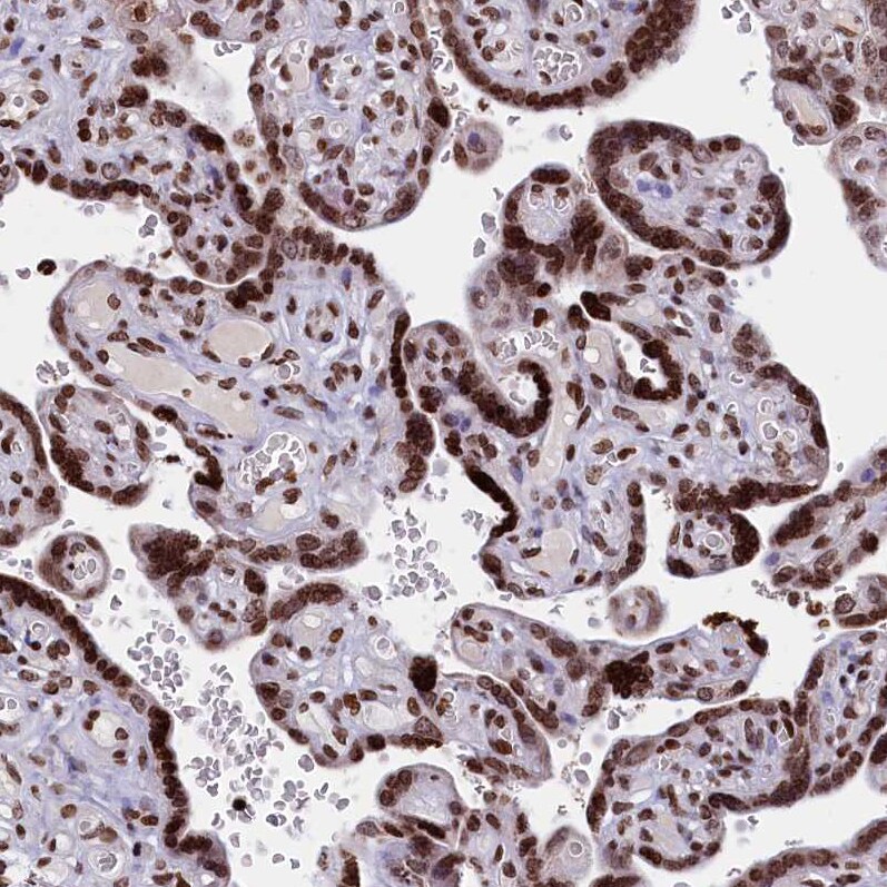 TIMM29 Antibody - BSA Free Immunohistochemistry: TIMM29 Antibody - BSA Free [NBP1-94151]