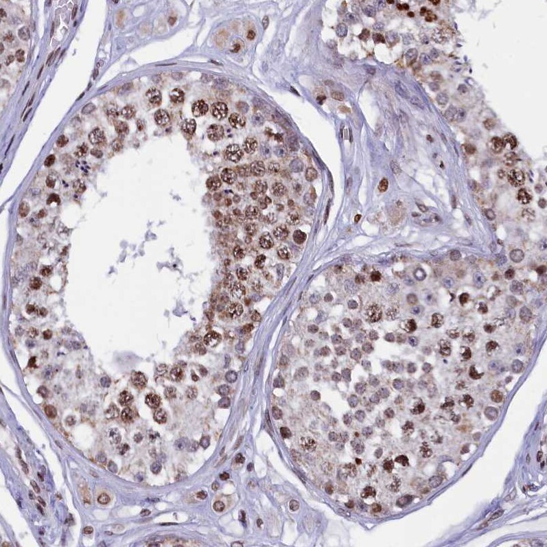 TIMM29 Antibody - BSA Free Immunohistochemistry: TIMM29 Antibody - BSA Free [NBP1-94151]