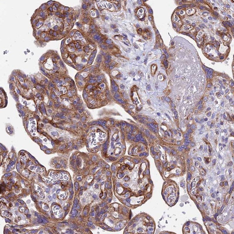 NG2/MCSP Antibody - BSA Free Immunohistochemistry: NG2/MCSP Antibody - BSA Free [NBP1-94154]