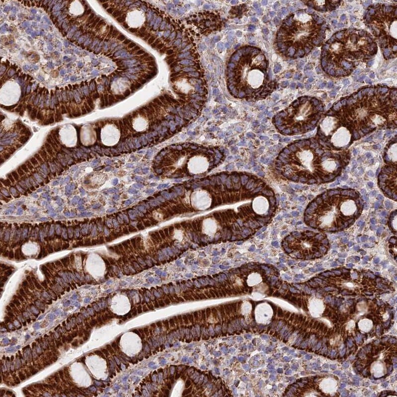 NG2/MCSP Antibody - BSA Free Immunohistochemistry: NG2/MCSP Antibody - BSA Free [NBP1-94154]