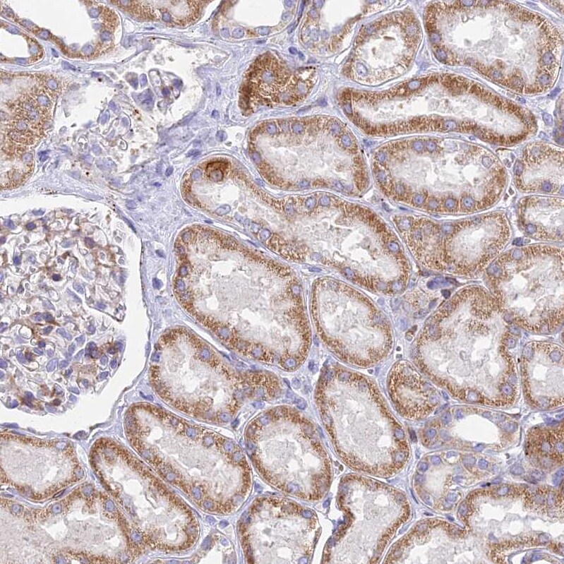 NG2/MCSP Antibody - BSA Free Immunohistochemistry: NG2/MCSP Antibody - BSA Free [NBP1-94154]