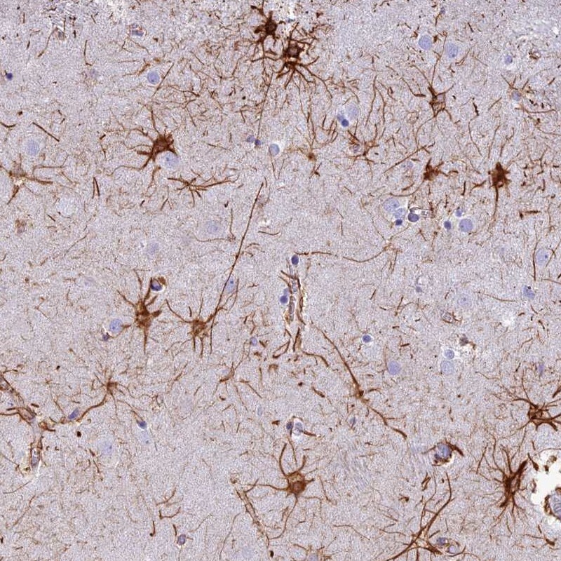 C17orf67 Antibody - BSA Free Immunohistochemistry: C17orf67 Antibody - BSA Free [NBP1-94155]