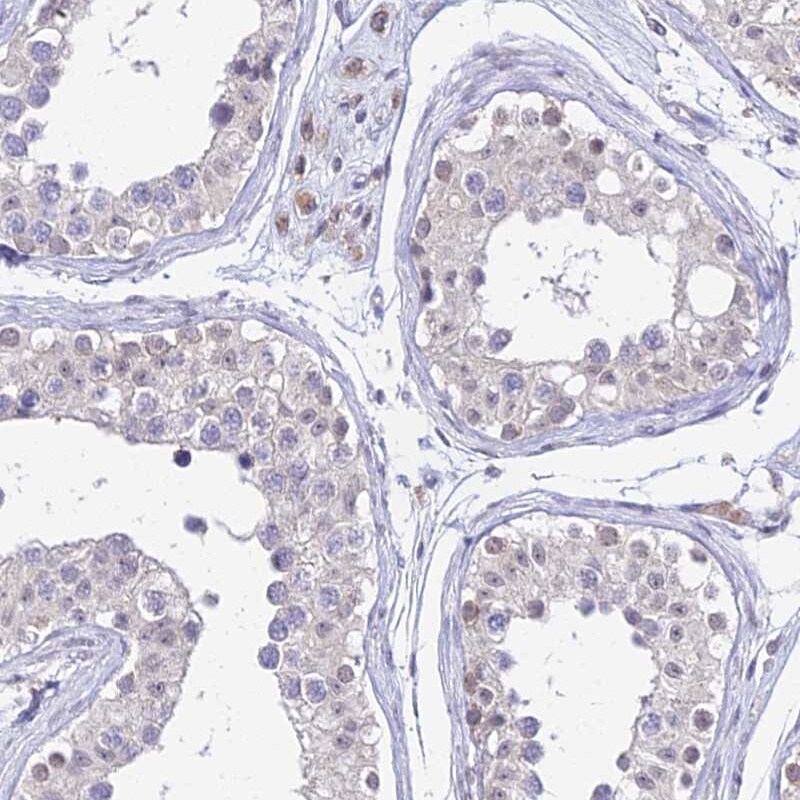 C6orf163 Antibody - BSA Free Immunohistochemistry: C6orf163 Antibody - BSA Free [NBP1-94165]