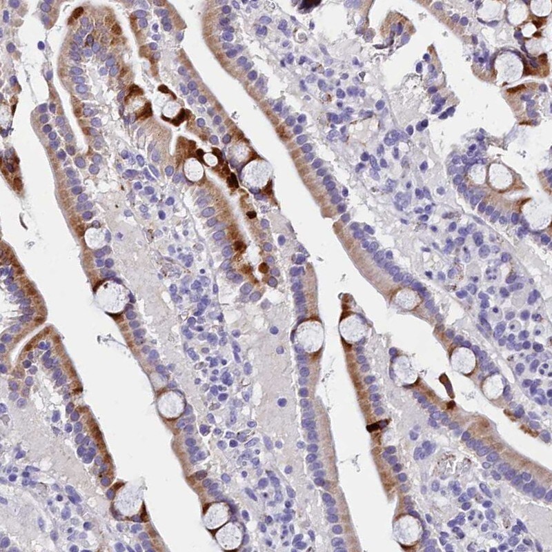 MS4A18 Antibody - BSA Free Immunohistochemistry: MS4A18 Antibody - BSA Free [NBP1-94170]
