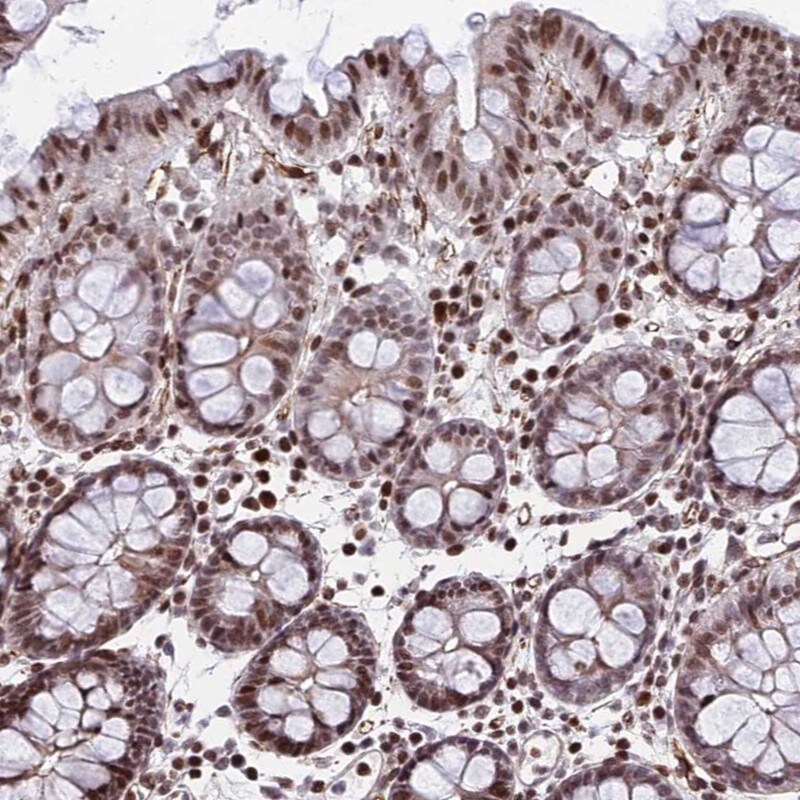 NYAP2 Antibody - BSA Free Immunohistochemistry: NYAP2 Antibody - BSA Free [NBP1-94175]