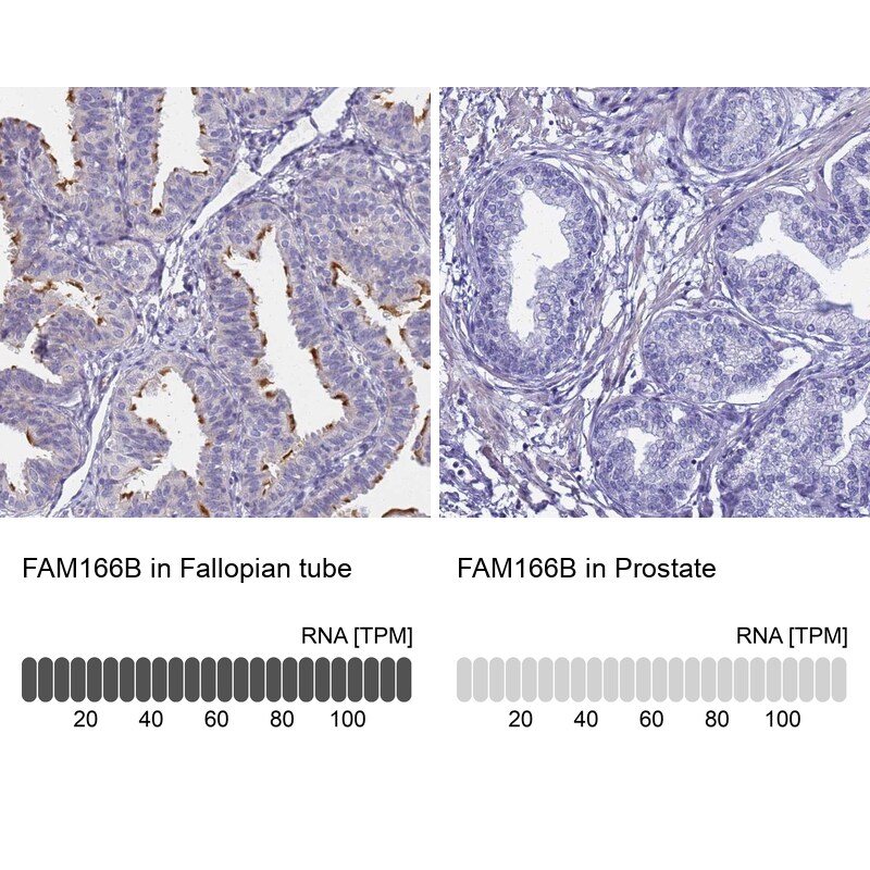 FAM166B Antibody - BSA Free Immunohistochemistry: FAM166B Antibody - BSA Free [NBP1-94176]