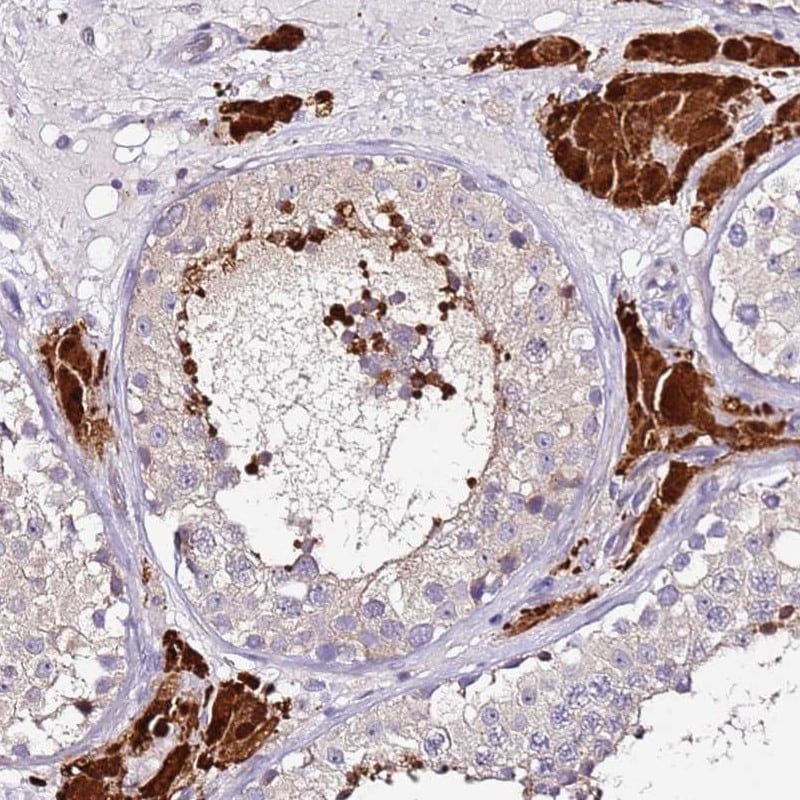 SRRM5 Antibody - BSA Free Immunohistochemistry: SRRM5 Antibody - BSA Free [NBP1-94187]