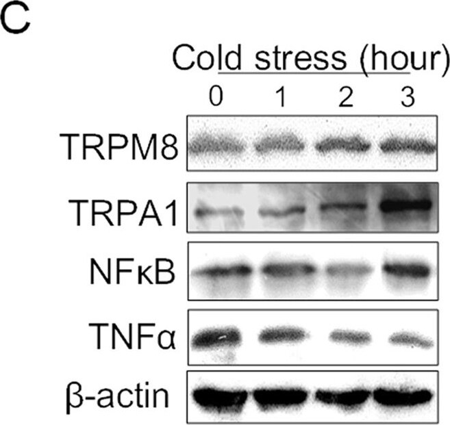 TRPM8 Antibody - BSA Free