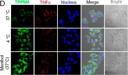 TRPM8 Antibody - BSA Free