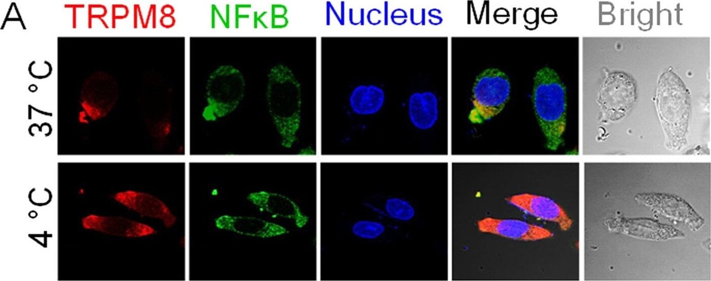 TRPM8 Antibody - BSA Free
