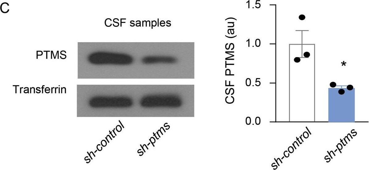 Transferrin Antibody