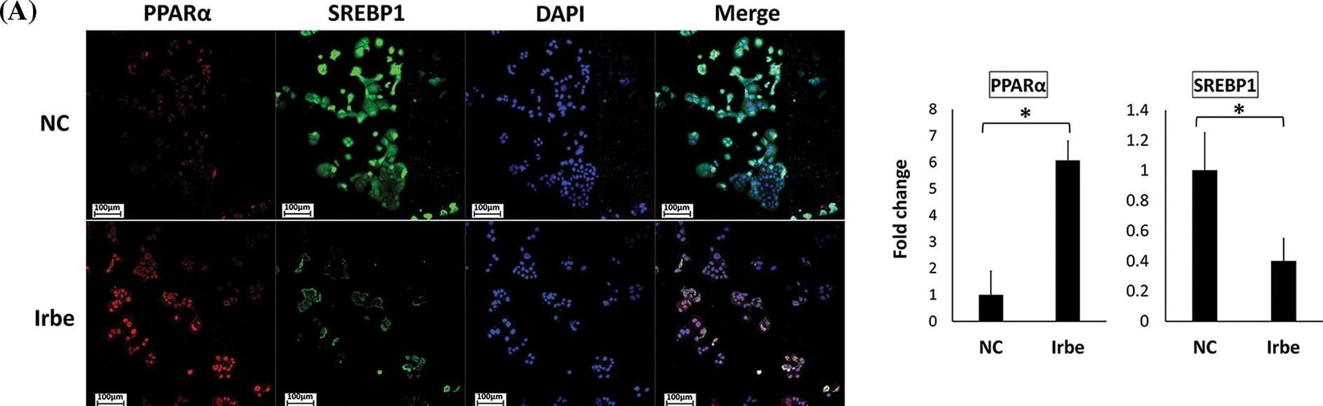 SREBP1 Antibody - BSA Free