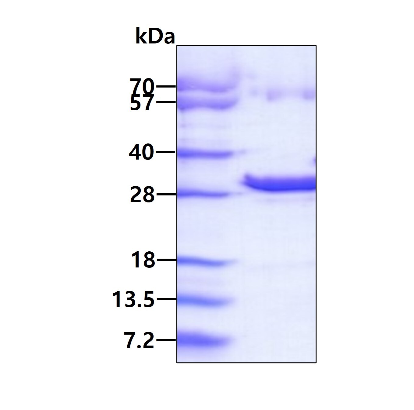 Recombinant Human Thymidine Kinase 2 His Protein
