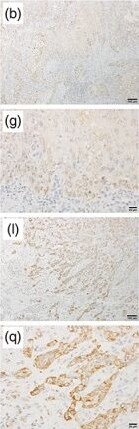 RGS5 Antibody (OTI1C1)