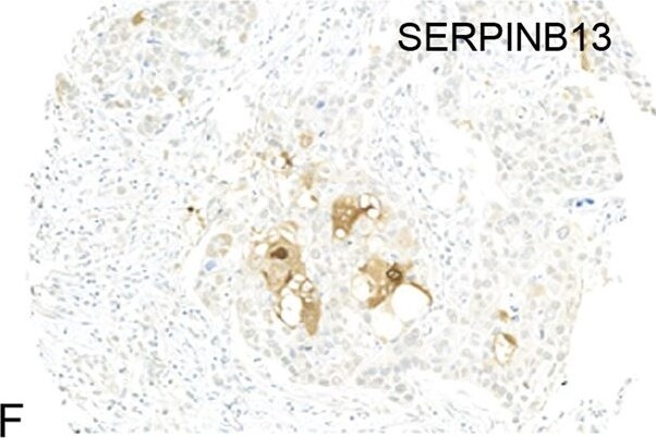 SERPINB13 Antibody (OTI2B6)