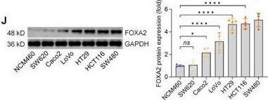 HNF-3 beta/FoxA2 Antibody (OTI3C10)
