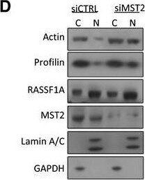 Profilin 1 Antibody (OTI1D5)