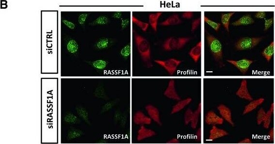 Profilin 1 Antibody (OTI1D5)