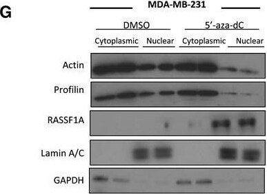 Profilin 1 Antibody (OTI1D5)
