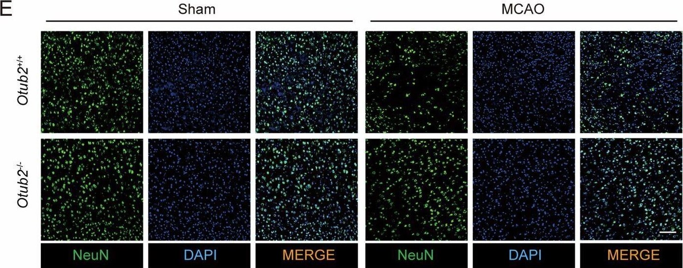 Otubain-2 Antibody (OTI11B3)
