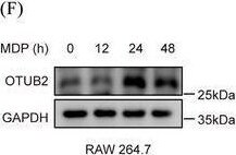Otubain-2 Antibody (OTI11B3)