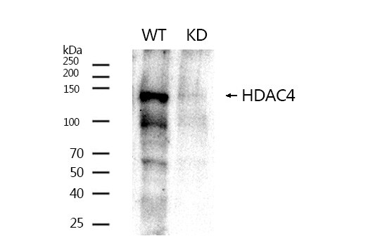 Histone Deacetylase 4/HDAC4 Antibody - BSA Free