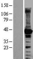 ARPC3 Overexpression Lysate