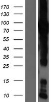 GFPT1 Overexpression Lysate