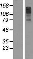 FBXL7 Overexpression Lysate