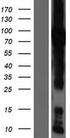 GFPT1 Overexpression Lysate